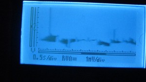 new world order heart beat 3